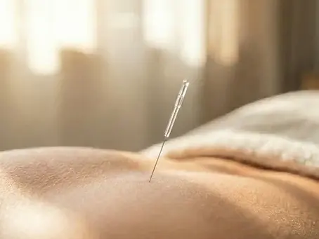 Your First Painless Acupuncture Session: From Anxiety to Relief
