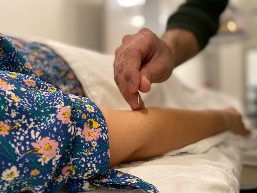 Pain after Acupuncture