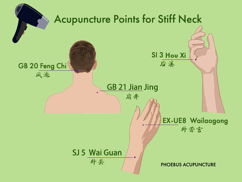 Acupuncture points for stiff neck