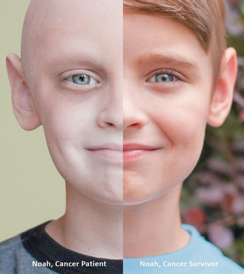What Is Cancer?