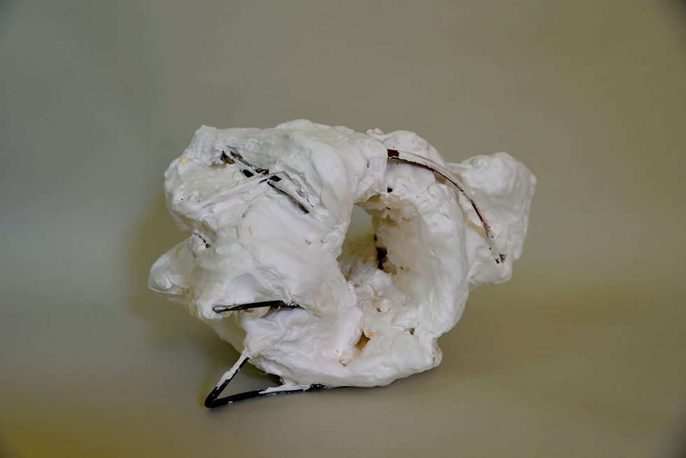 Headache, 2014