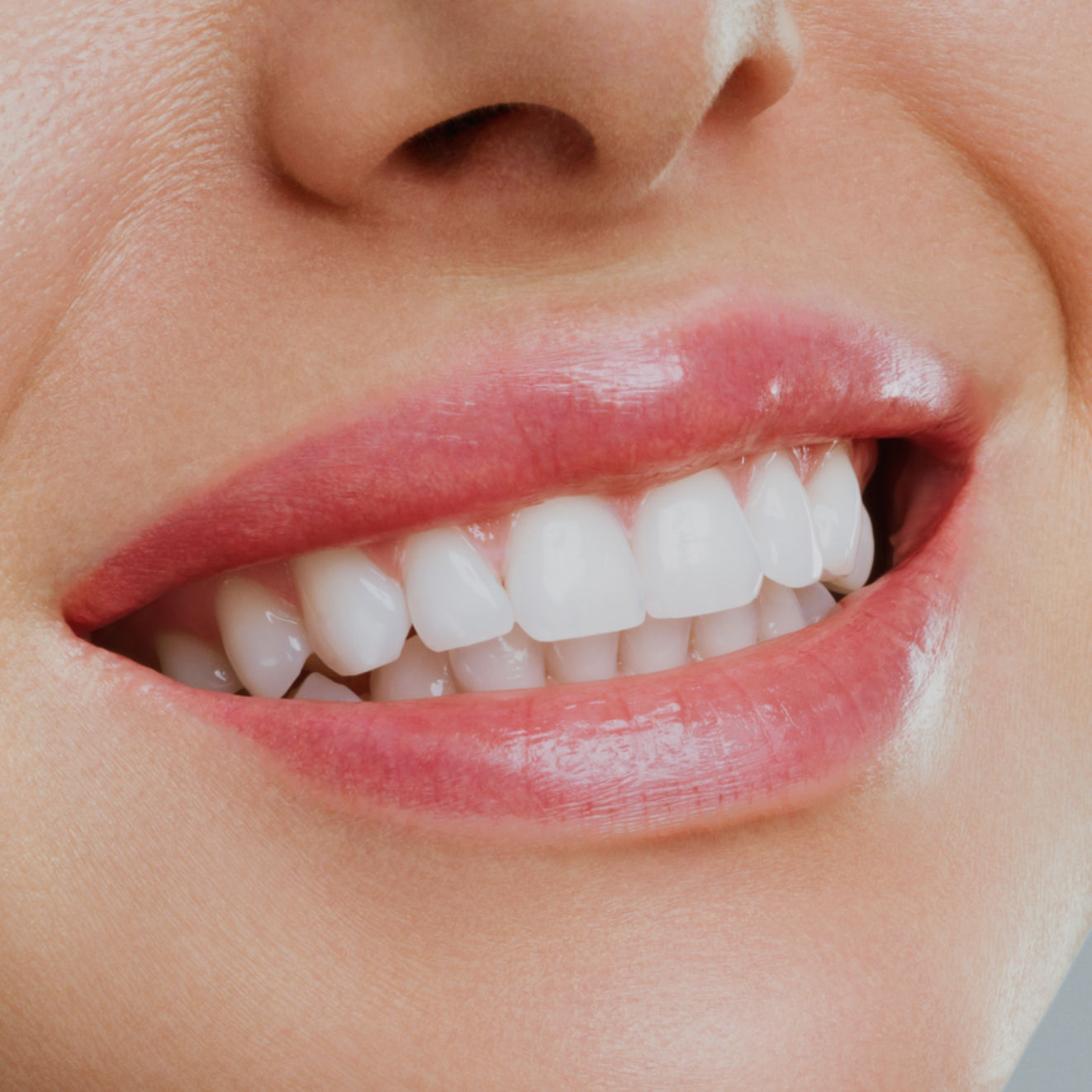 Pearliest Of All Whites: 2x Teeth Whitening Treatments