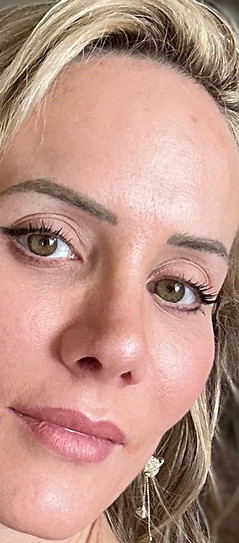 Glowing skin, natural Botox and filler results