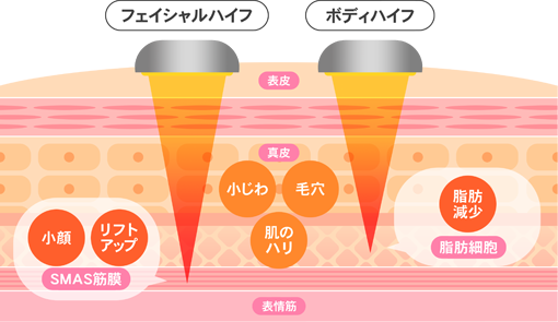 ハイフ.png
