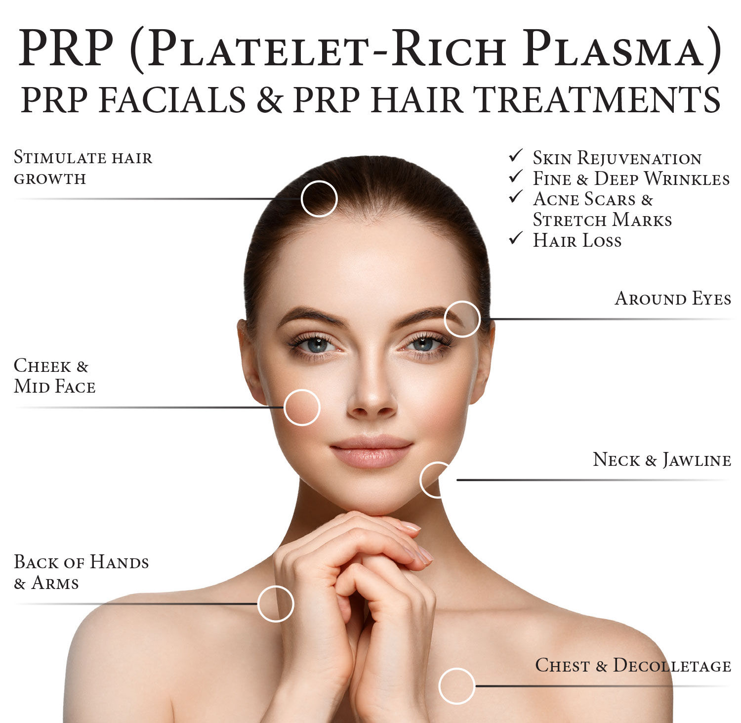 PRP Treatment