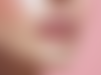 Is the Lip Filler Trend Going Away in Miami?