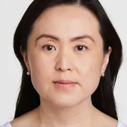 Ultherapy: Non-Invasive Skin Tightening & Lifting Treatment