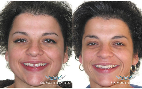 before&after3.jpg