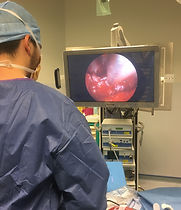 Chirurgie endoscopique des sinus