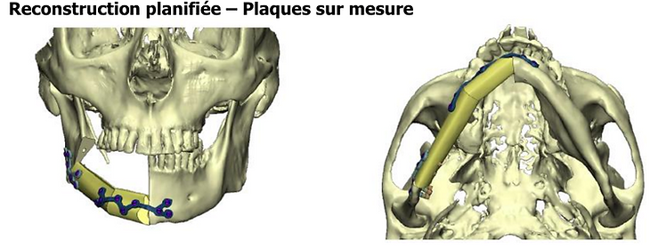 Matérialise ORL Pontoise