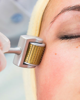 Medical cosmetic procedure. Mikronidling