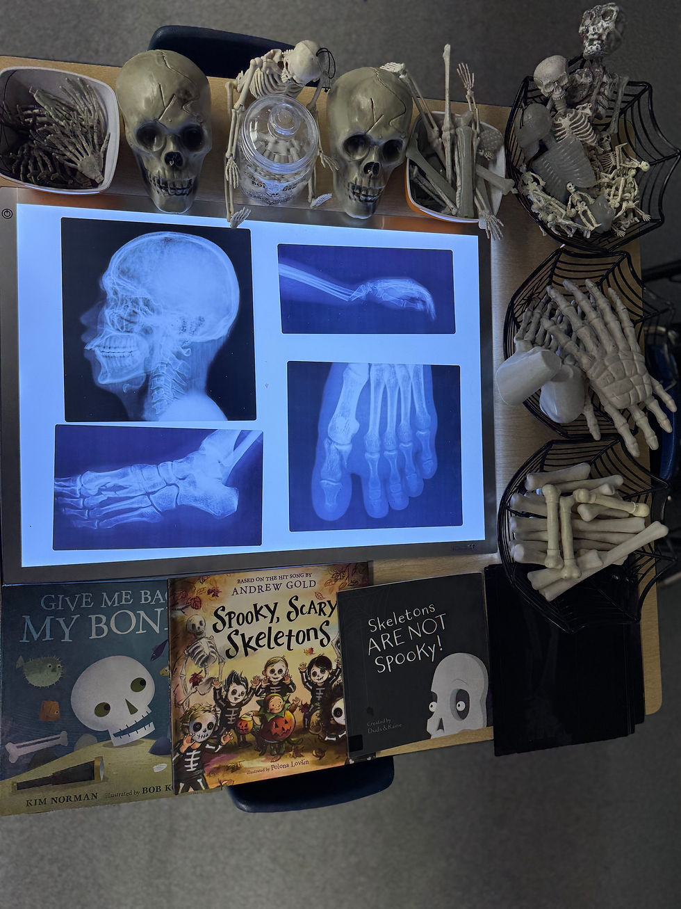 Invitation to Explore Skeletons, Bones, & X-Rays