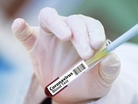 Coronavirus: Oxford vaccine triggers immune response!