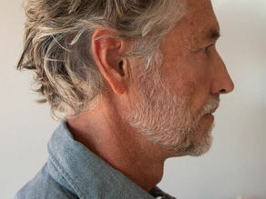 The word "cure" is often a misnomer when it comes to tinnitus. Instead, the clinical gold standard in 2026 is Habituation.