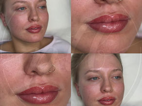 Everything You Need to Know About Lip Blush