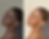 Before-and-after comparison of a girl's photo edited with Clean Girl Mobile Presets, showcasing the transformation to a luminous 'glass skin' effect. The 'before' image features original skin tones, while the 'after' highlights enhanced radiance, smooth textures, and a fresh, polished look, demonstrating the presets' ability to create a clean and glowing aesthetic