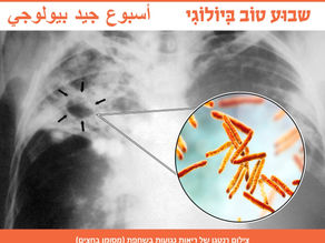 כיצד יכולה בינה מלאכותית לסייע בשיפור הטיפול בשחפת?