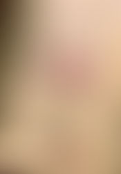 PRRP (Reciprocal Parallel COPD) Panel 8&9