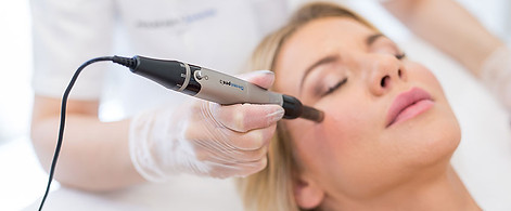 dermapen_tretman_poliklinika_bagatin_1.j