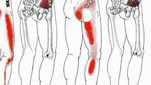 Insights on HIP/Piriformis pain