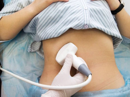 She Had No Symptoms. Her Wellness Ultrasound Told a Different Story.