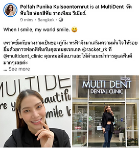 ฟอกสีฟันที่ไหนดี