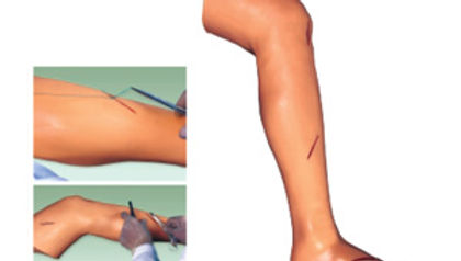 Advanced Surgical Suture Leg