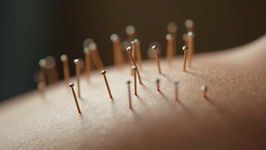 Top Natural Pain Management Methods for Effective Pain Relief