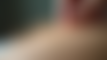 Discovering the Acupuncture Benefits for Health: A Gentle Path to Wellness