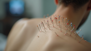 Discovering the Acupuncture Benefits for Health