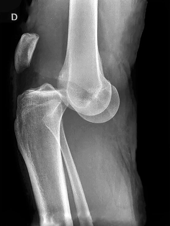 lux rodilla.jpg