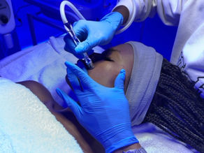 Diamond Glow Microdermabrasion Facial in Roswell, GA: A Deeper Dive into Diamond Microdermabrasion at Luminance Beauty & Body Spa