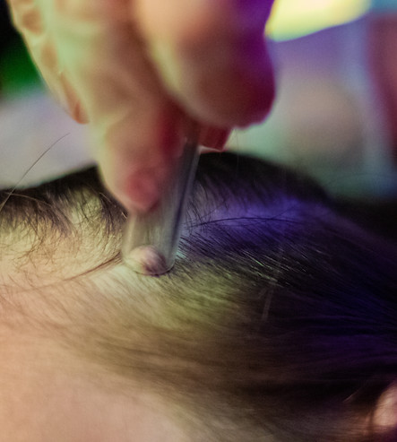 Vacumterapia (2).jpg