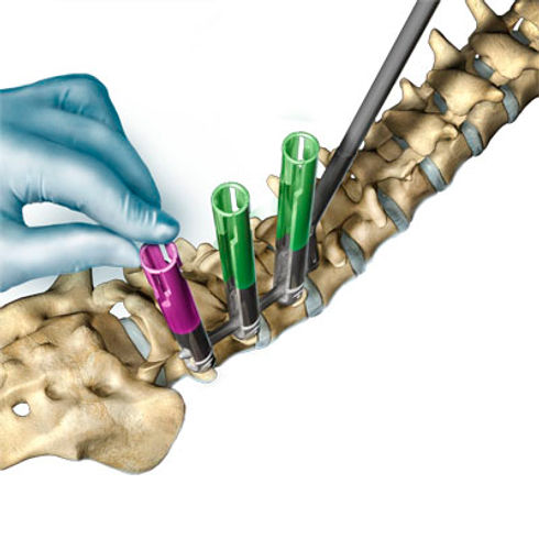 Spine Photo.jpg