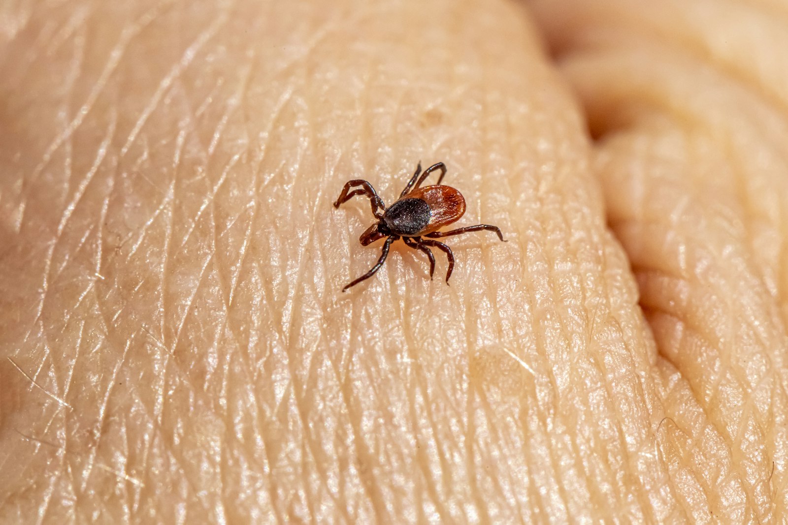 Tick crawling on a person's arm