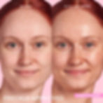 Miniatura: Watermelon Glow Niacinamide Hue Drops Sun Glow Serum