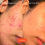 Miniatura: SOS Daily Rescue Facial Spray with Hypochlorous Acid