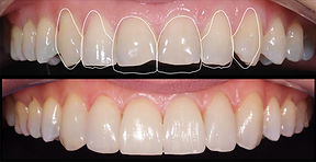 estetica anterior