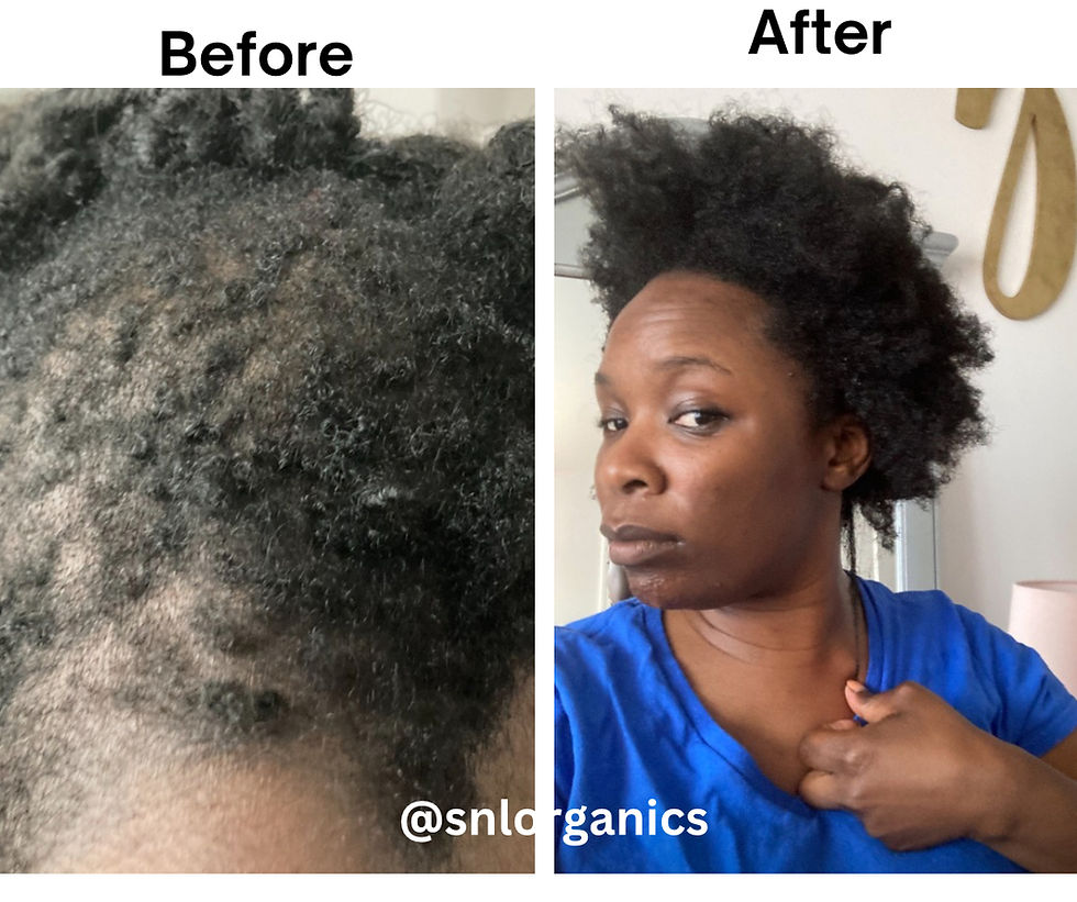 Thumbnail: Advance Fenugreek & Hibiscus Growth Set