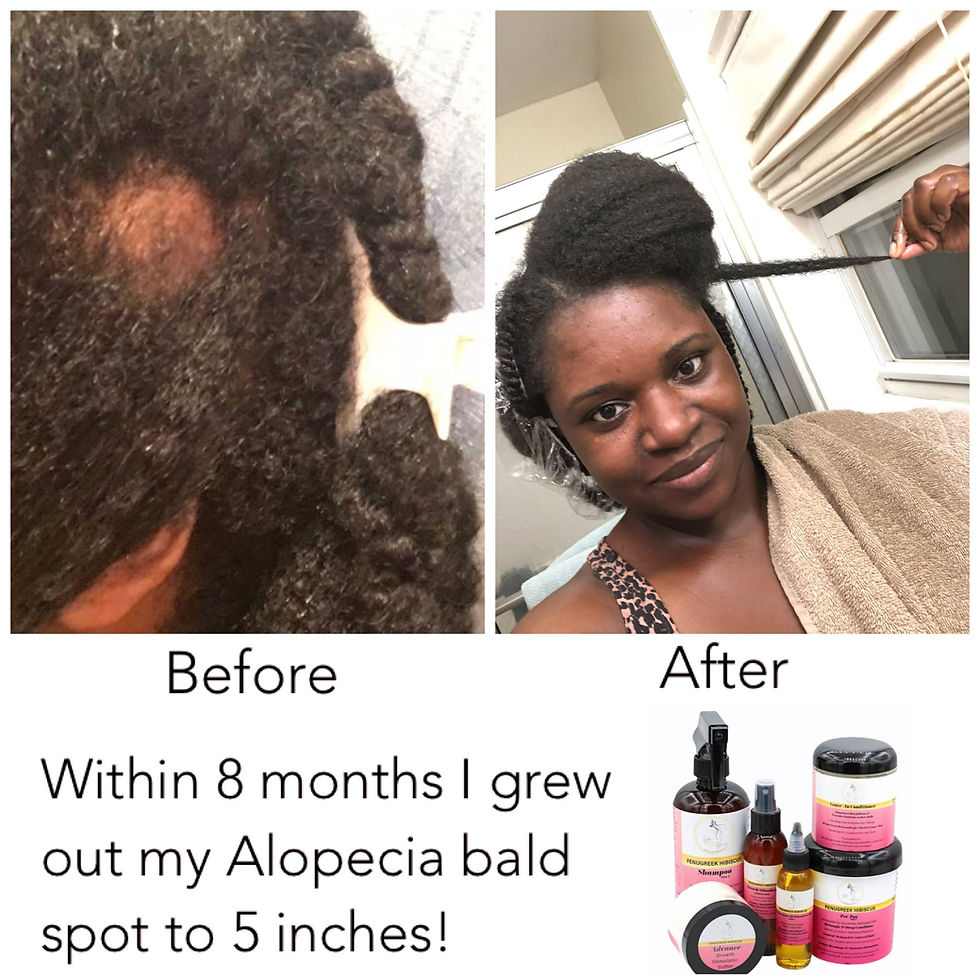 Thumbnail: Advance Hair Growth Leave-in Conditioner (8oz)