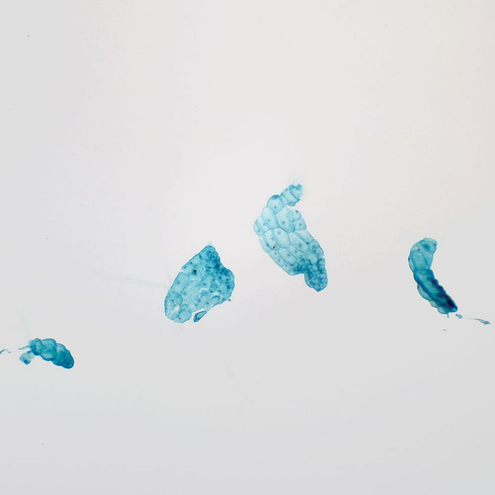 Fern Prothallium, Filamentous, w.m. Microscope Slide