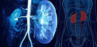 UROLOGY