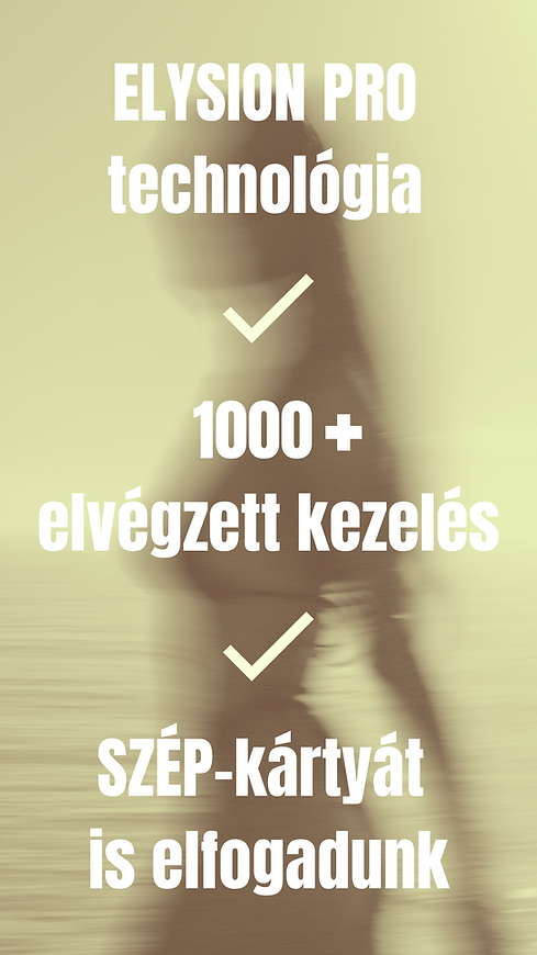 SZÉP-kártyát is elfogadunk.png