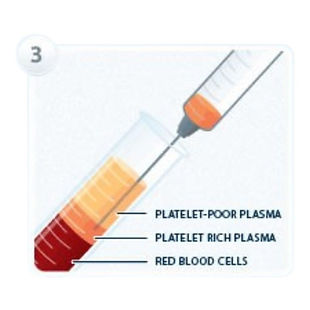 PRP - Centro Medico Diagnostico - San Giuseppe Moscati