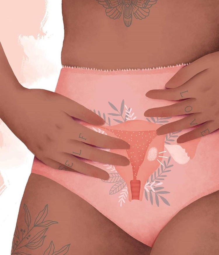 PCOS and Endometriosis