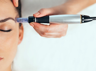 microneedling-1465x1099-c-center.jpg
