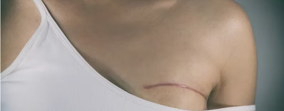 Post-Reconstruction-Surgery-Treatment-Pro-X-Physical-Therapy-Agoura-Hills-California