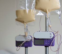 Couple of feeding pump medical device purple color to supplement nutrition liquid food to