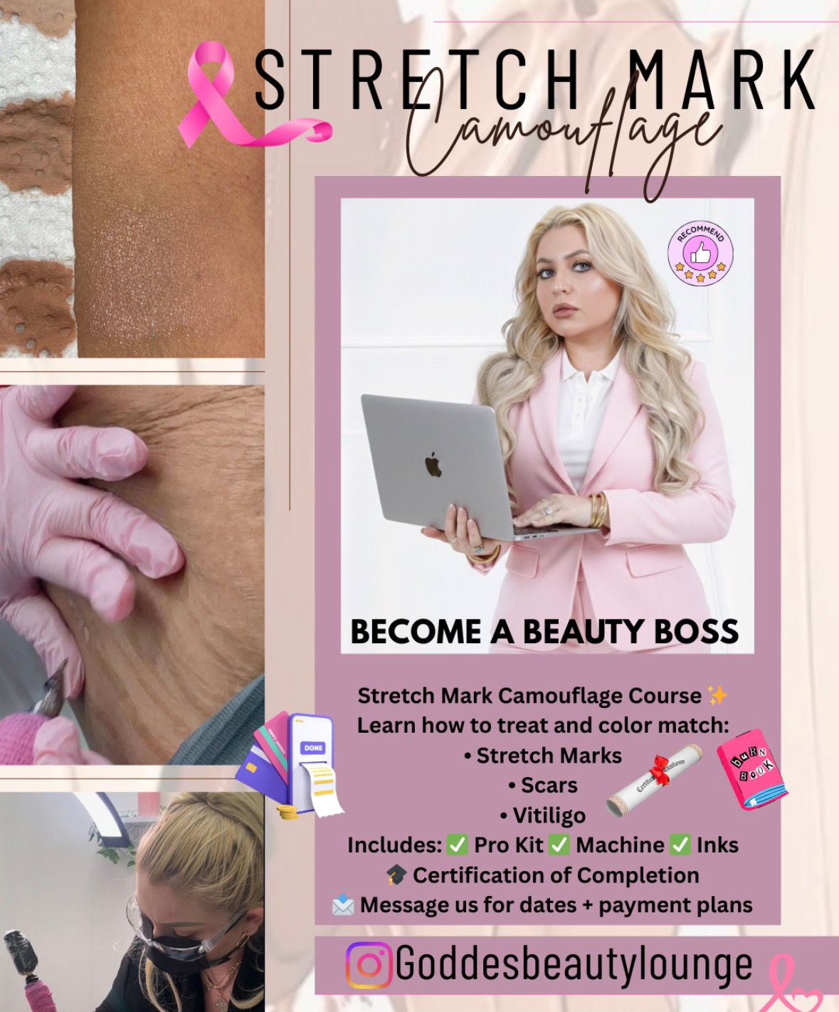 Stretch Mark Camouflage Paramedical Tattoo 