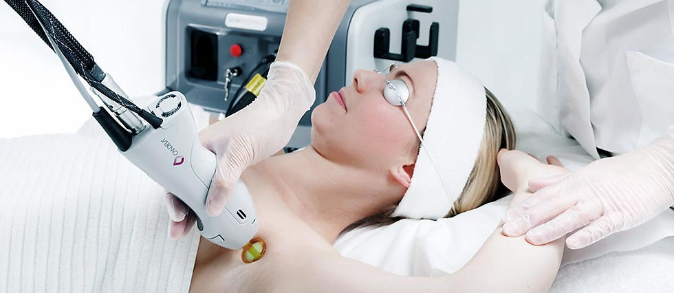 epilation-laser-antibes